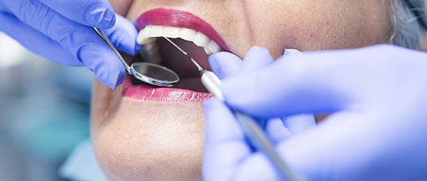 Best Emergency Root Canal Treatment in Lacoste, TX